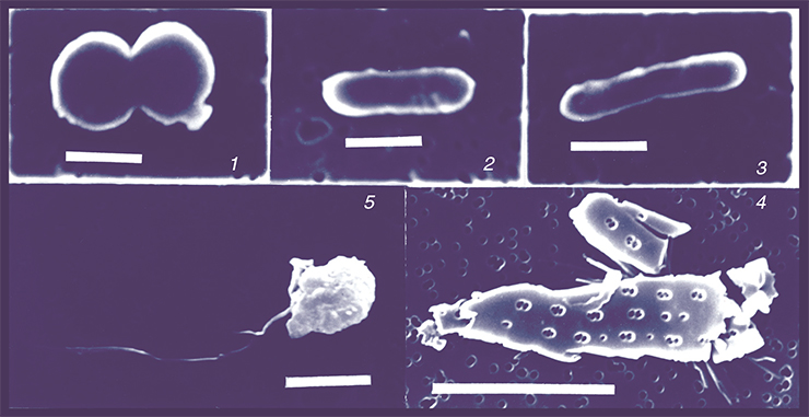 Содержимое кишечника эпишуры (сканирующий электронный микроскоп): 1 – Synechocystis Sauv., 2–3 — Synechococcus Nag. (пикоцианобактерии); 4 – Chrysophyta, 5 – Aulacoseira baicalensis. 1–3 – шкала 1 мкм, 4 – 4 мкм, 5 – 10 мкм